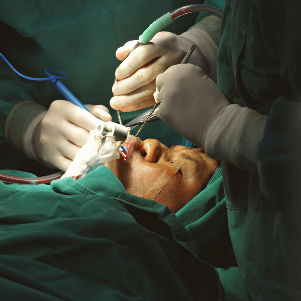 Salvage Head and Neck Surgery