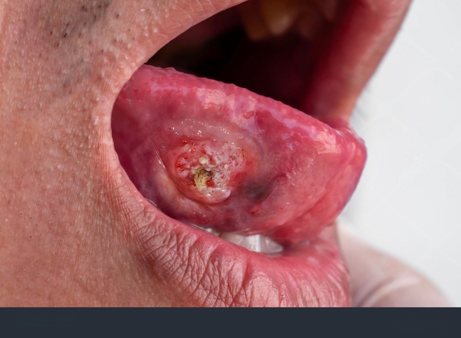 Oral cavity illustration